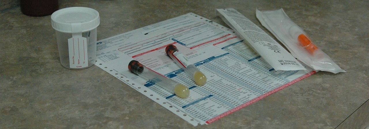 Urinprobe